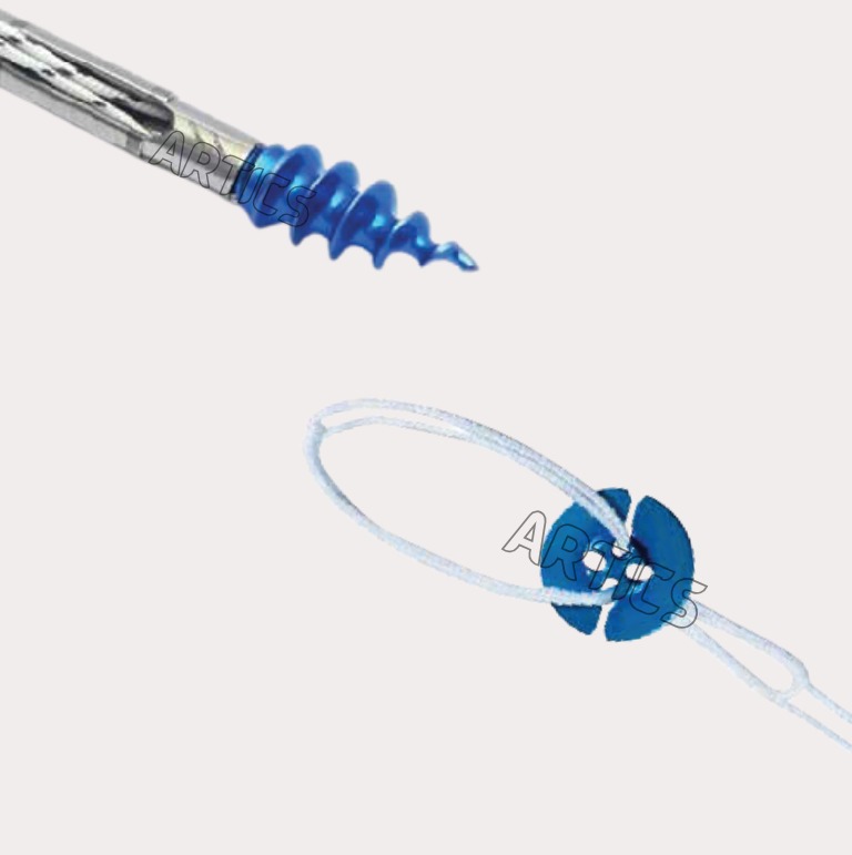Arthroscopy Implants